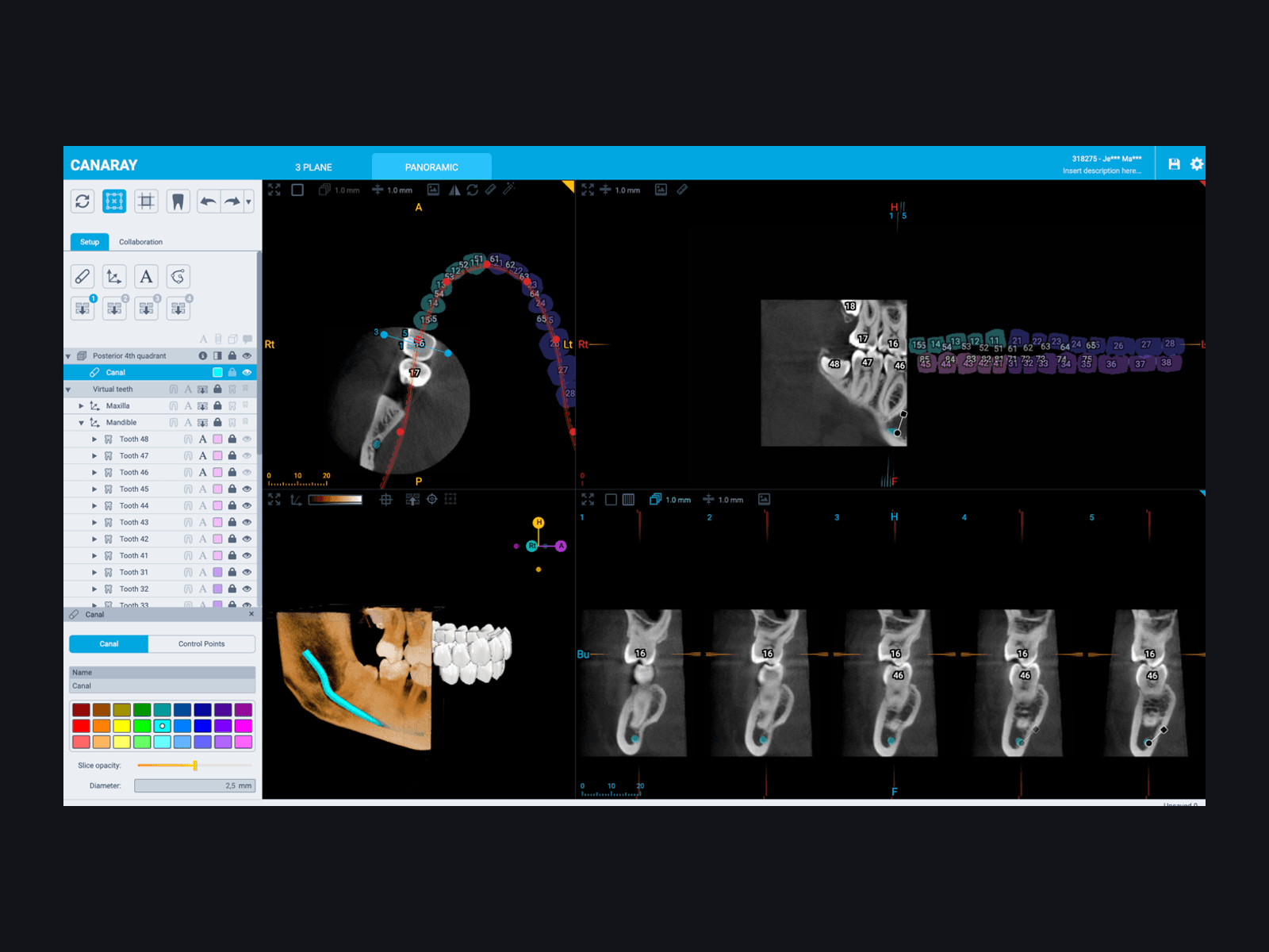 Voxel 3D dental imaging software interface